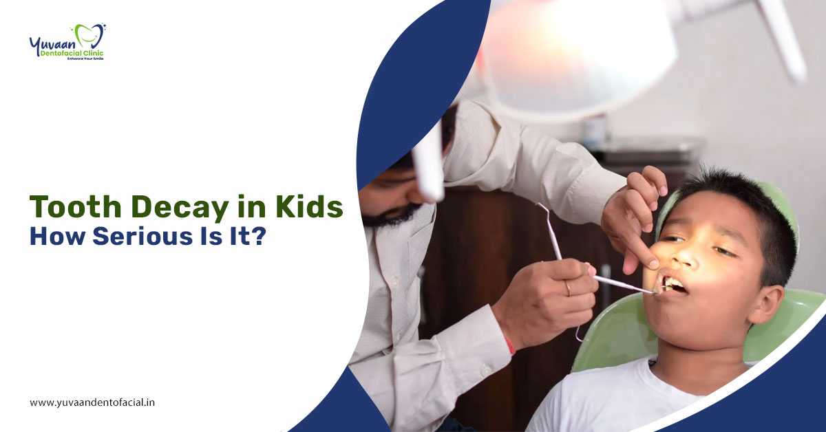 Tooth Decay in Kids: How Serious Is It?