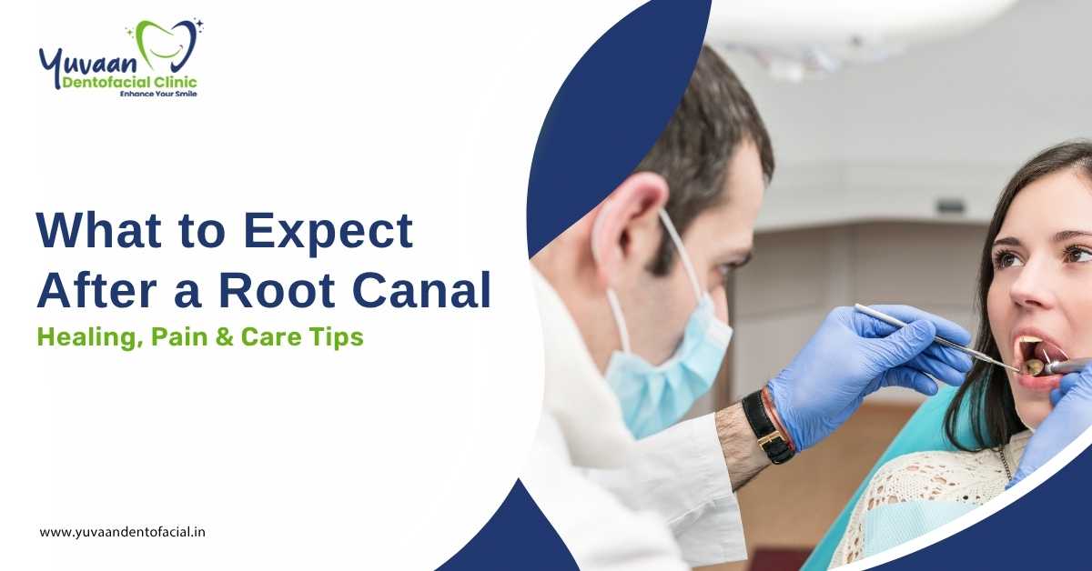What to Expect After a Root Canal Healing, Pain & Care Tips