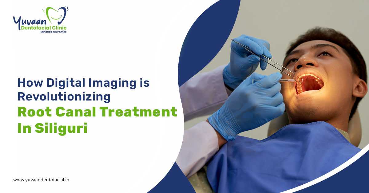 How Digital Imaging is Revolutionizing Root Canal Treatment in Siliguri