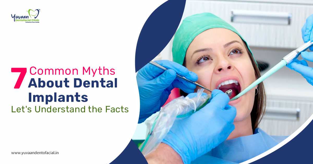 7 Common Myths about Dental Implants: Let's Understand the Facts