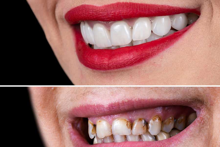Cosmetic Dentistry