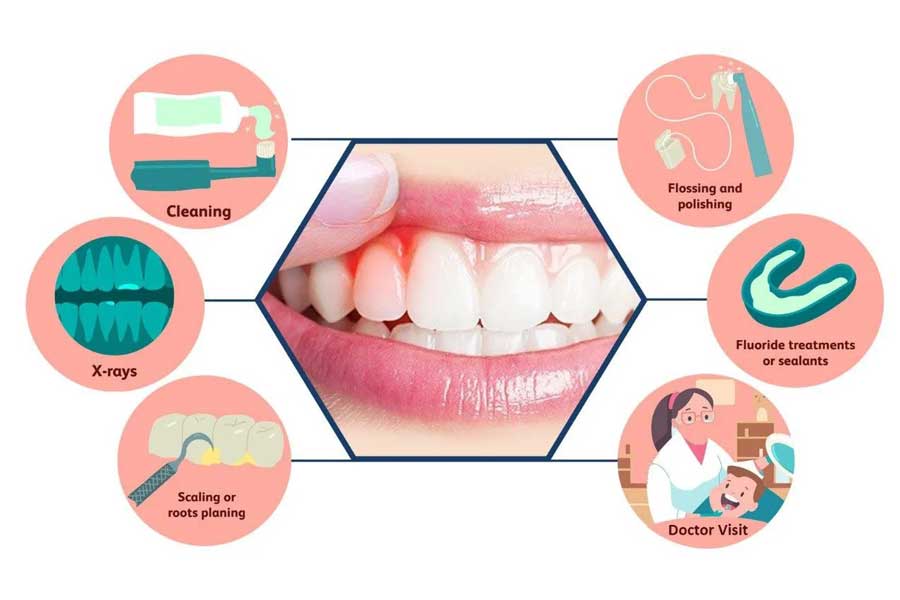 Gums & Gingiva Treatment