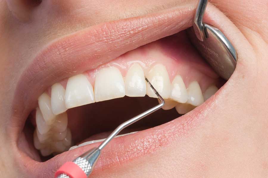 Periodontics Service